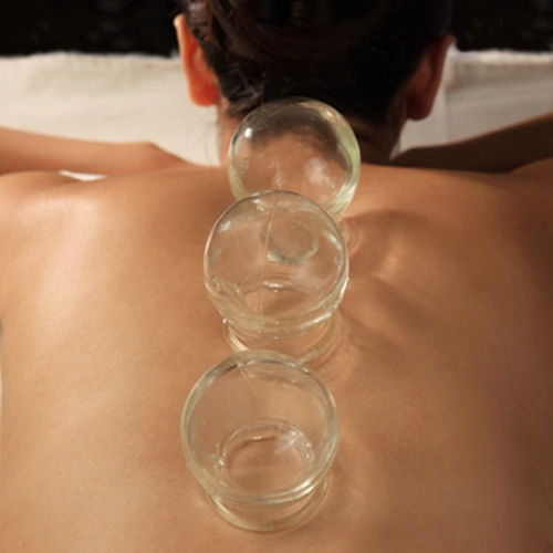 Chiropractic Westchase FL Woman Receiving Cupping Therapy